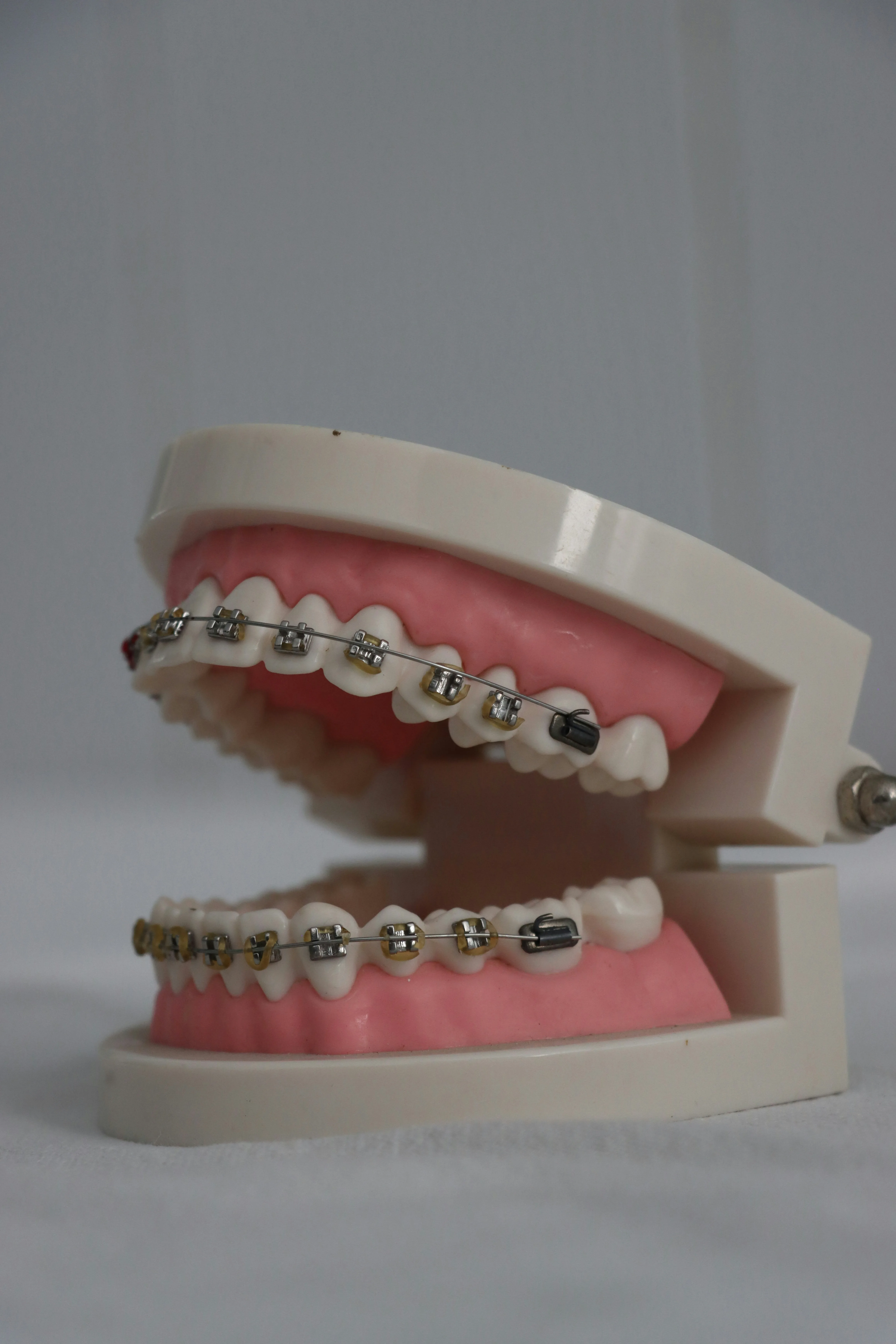 Braces Dental Care